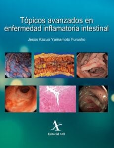 Tópicos avanzados en enfermedad inflamatoria intestinal