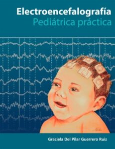 Publication 15 Electroencefalografía Pediatría Práctica