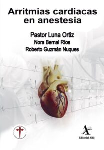 Arritmias cardiacas en anestesia