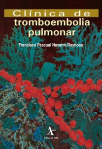 Publication 6 Clínica de tromboembolia pulmonar
