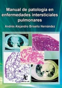 Manual de patología en enfermedades intersticiales pulmonares
