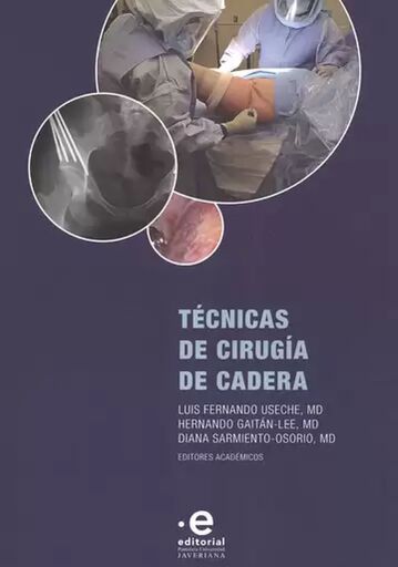 Técnicas de cirugía de cadera